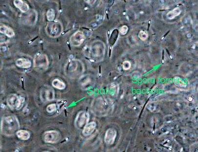 細菌の人生における胞子の役割は何ですか？